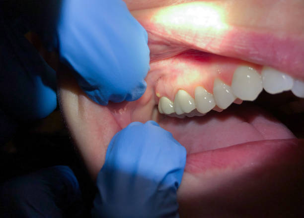 Best Same-Day Emergency Dental Services in Ashville, AL