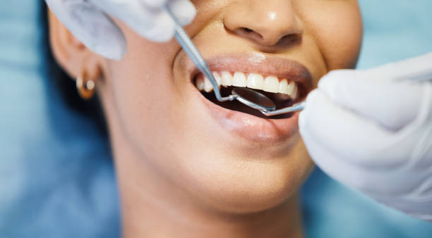 Best Cosmetic Emergency Dentistry in Ashville, AL