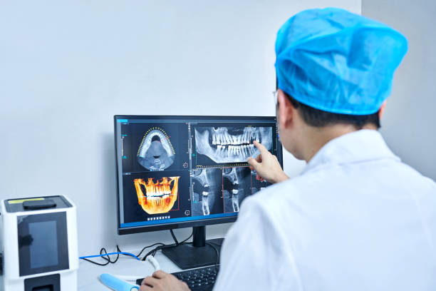 Best Emergency Root Canal Treatment in Ashville, AL