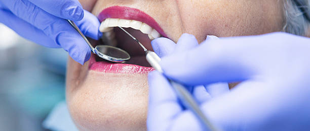 Best Emergency Tooth Extraction in Ashville, AL